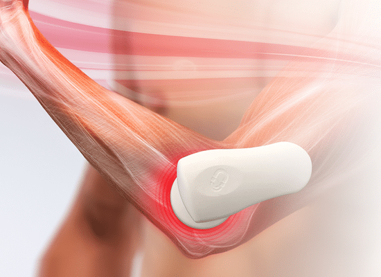 TECAR therapy applied to a patient's elbow